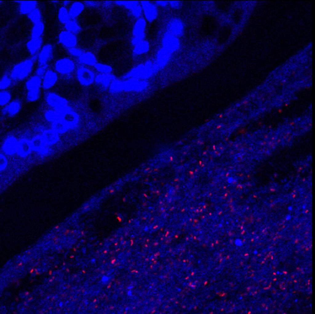 FISH Staining Of The Intestinal/Microbe Interface | Chang Lab ...